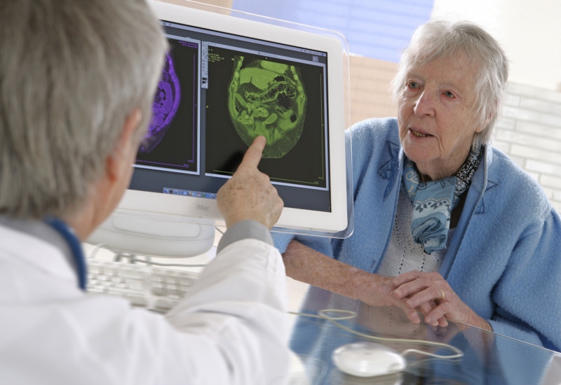 Alzheimer: prevenire con l'allenamento del cervello e la memoria 