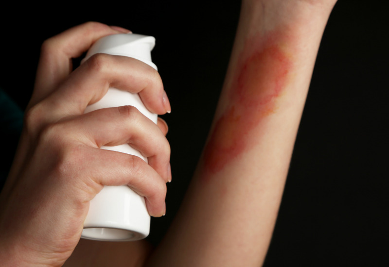 Pelle spray per il trattamento delle ferite difficili 